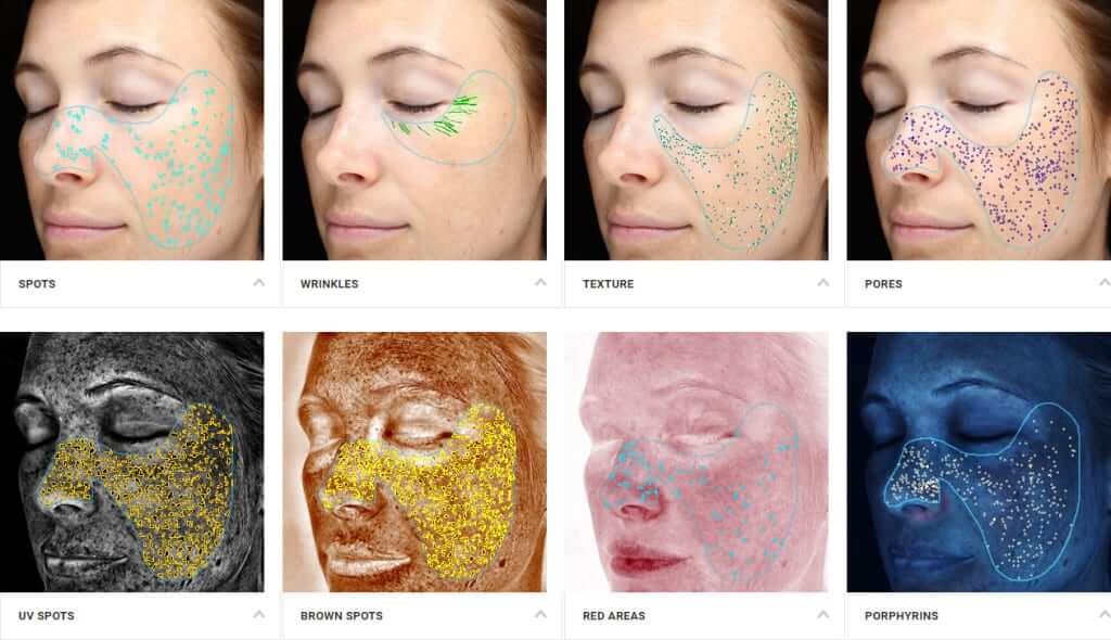 Different skin textures shown due to age, and damage using Visa Complexion Analysis